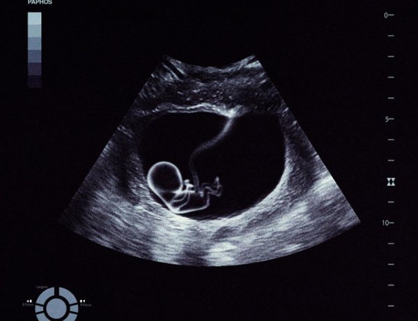 Vacra - En Attendant Paphos (Album complet)